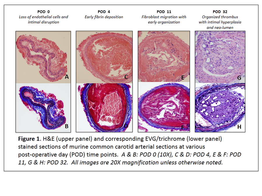 06 08 Development Of A Novel Murine Carotid Artery Neointimal Hyperplasia Model Academic Surgical Congress Abstracts Archive