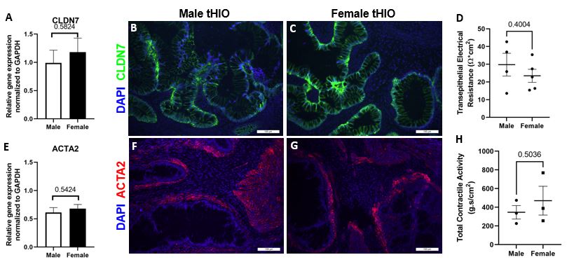 41 03 Host Sex As A Biological Variable In Barrier And Contractile Function Of Human Intestinal