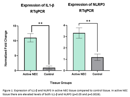 ordinary glutathione serum 29.08 The Role of NADPH Oxidase's and their Contribution to Cell Death in  Necrotizing Enterocolitis