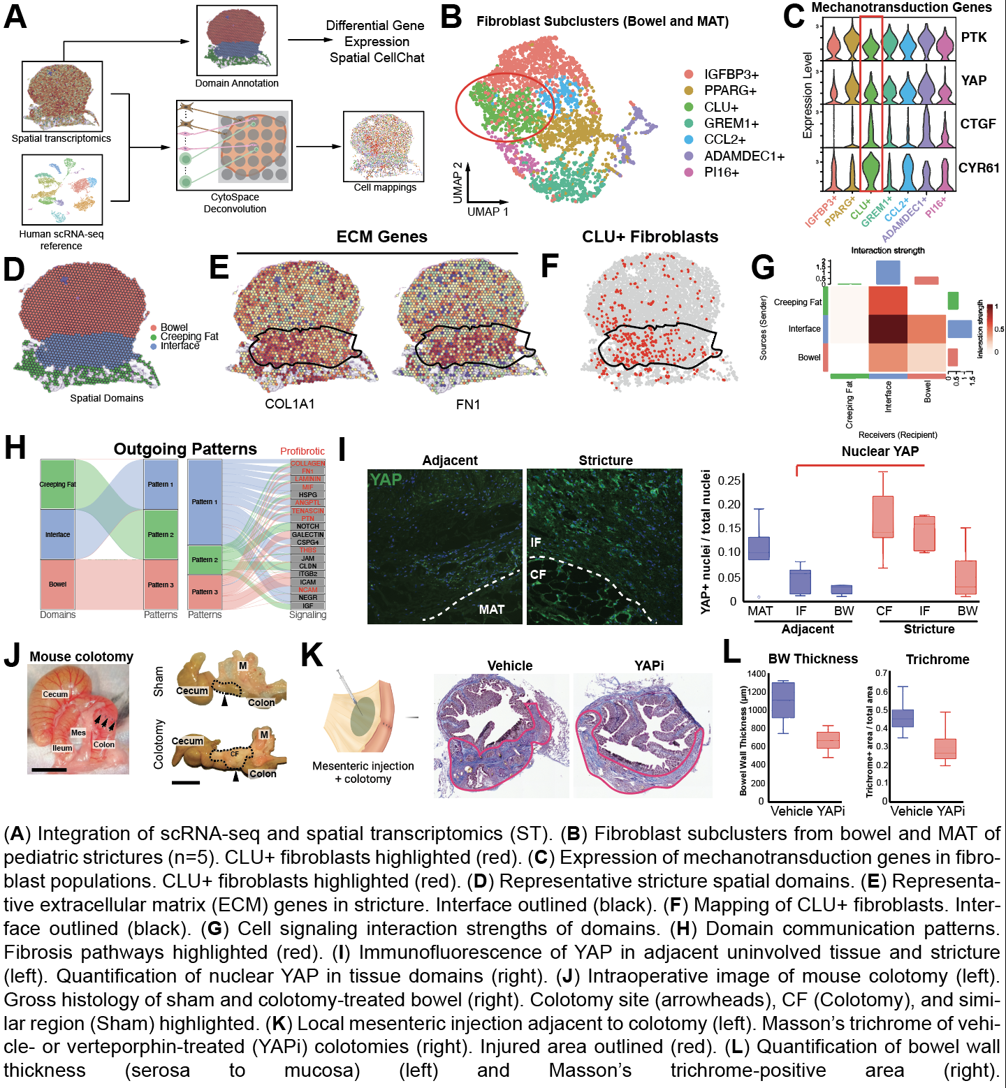 69.02 Creeping fat-derived mechanosensitive fibroblasts drive stricture ...